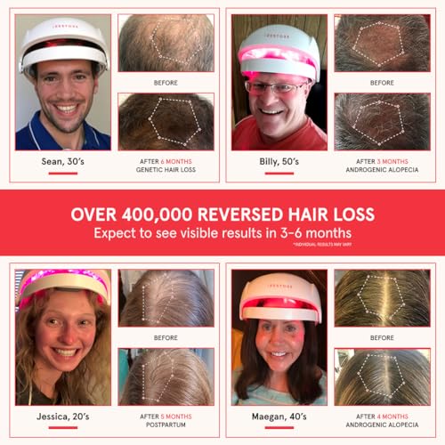 FDA Cleared Laser Hair Growth System T712274